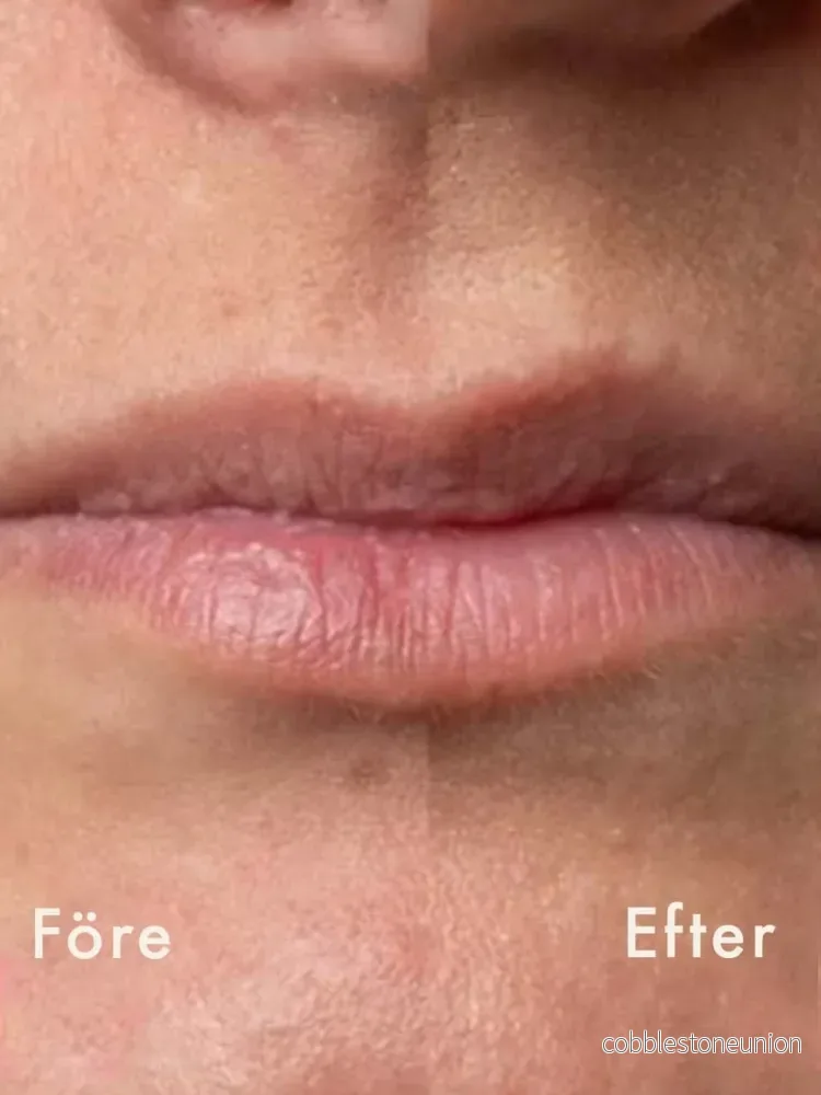 Trew - Peel Lip - AHA/BHA Exfolierande Läppvård - Bild 2