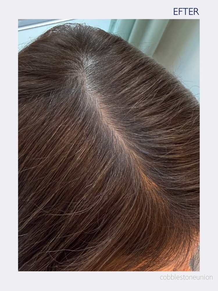 Instant Root Retouch - Bild 3